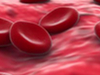 میزان قند خون هدف در درمان دیابت چقدر است؟
